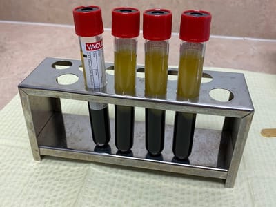 Idaho Falls Smiles Justin G Frandsen DDS and Brandon S. Griffin DMD