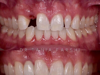Implant Dentist of LA