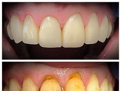 Implant Dentist of LA