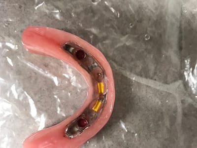 Implant Dentist of LA