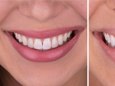 Ingenic Dental Studio - Dr Jake Modery