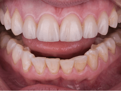 Ingenic Dental Studio - Dr Jake Modery