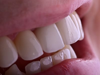 Jackson Smiles Family Dentistry