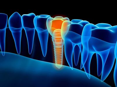 James V. Bachman, DMD