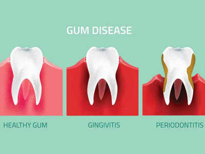James V. Bachman, DMD