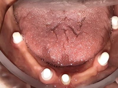 John G Masso DDS- Belcourt Family Dentistry PC