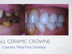 John G Masso DDS- Belcourt Family Dentistry PC