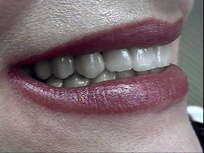 John G Masso DDS- Belcourt Family Dentistry PC