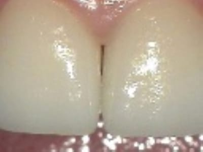 Jorge F. Zapata DDS - Gentle Family Dentistry