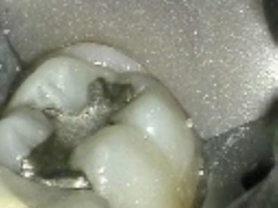 Jorge F. Zapata DDS - Gentle Family Dentistry