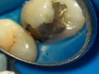 Jorge F. Zapata DDS - Gentle Family Dentistry