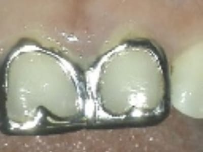 Jorge F. Zapata DDS - Gentle Family Dentistry