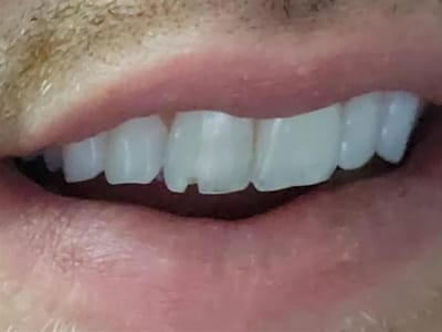 Just Smiles - General, Cosmetic & Implant Dentistry