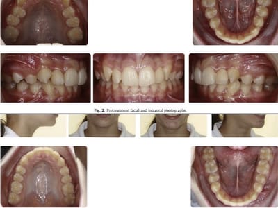 Justin Dental and Braces