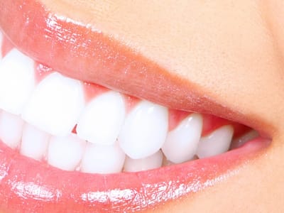 Katy Dental Experts - General Dentist and Cosmetic Dentistry