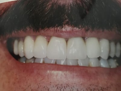 Kauai Kilauea Dentist Dr. Ileana Carreno, DDS