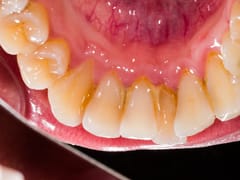 Kingston Dental Care in St. Louis, MO