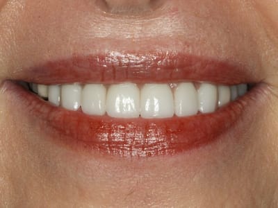 Koehn Dentistry & Aesthetics