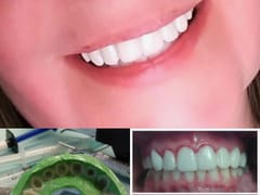 Lake Travis Family & Cosmetic Dentistry - Austin