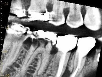 Lake Wales Dentistry