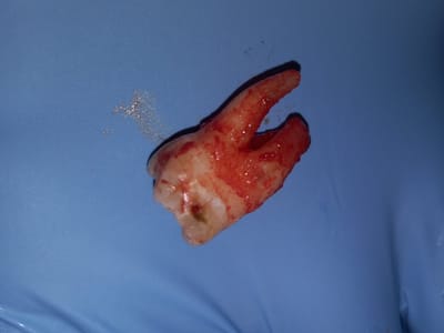 Lake Worth Dentistry