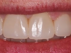 Lakeland Dental Care