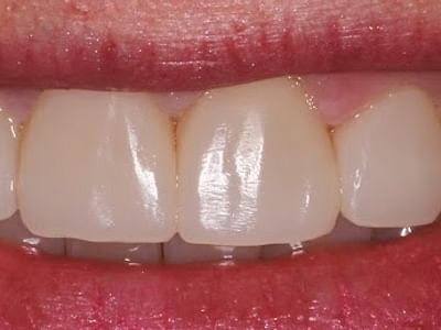 Lakeland Dental Care