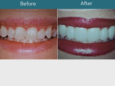 Lakeside Dental Solutions