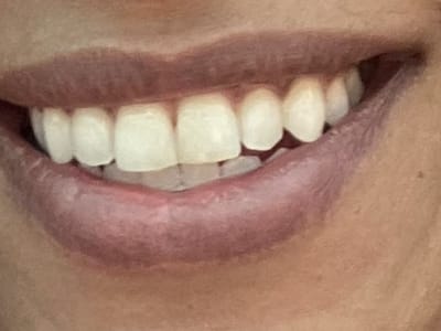 Larry D. Herwig, DDS