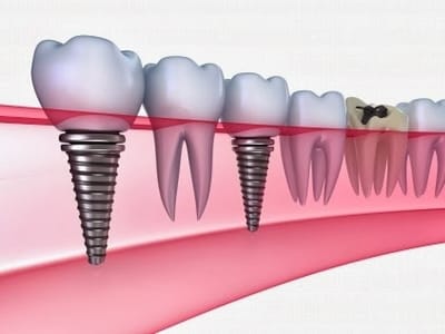 Las Vegas Dental Group