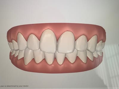 Lasting Impressions Dental Spa | Dentist Encino