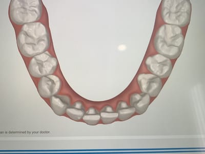 Lasting Impressions Dental Spa | Dentist Encino