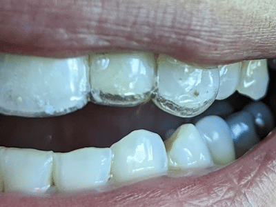 Laurel Smile Dentistry