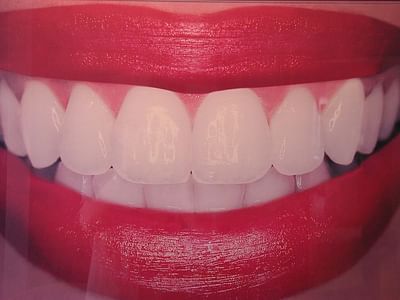 Laurich Dentistry Canton - Douglas A. Callow, DDS