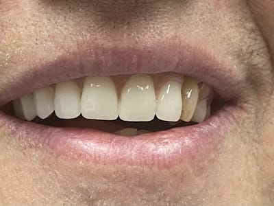 Lehigh Valley Cosmetic Dentistry