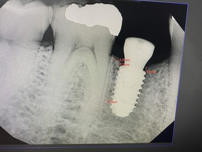 Lehigh Valley Cosmetic Dentistry