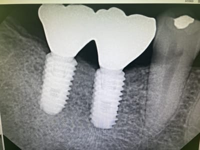 Lehighton Family Dentistry