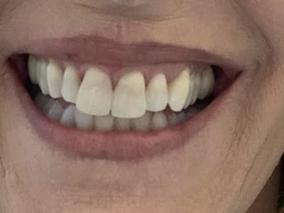 Leon Springs Modern Dentistry