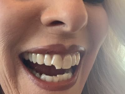 Leon Springs Modern Dentistry