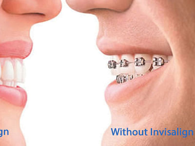 LifeSmiles complete health dentistry