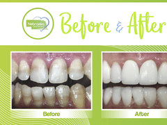 Lincoln Family Dentistry