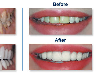 Lindsten Dentistry of Rockford