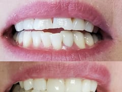 Long Falls Dentistry