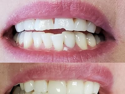 Long Falls Dentistry