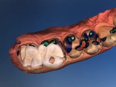 Los Angeles Dental Arts: Theodore Burnett, DDS