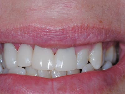 Love Dentistry - Dr. Sheri Love, DDS