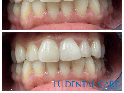Lu Dental Care - Alhambra Dentist
