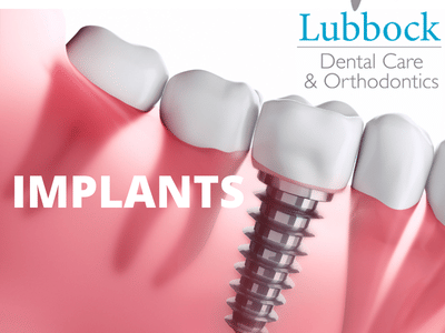 Lubbock Dental Care