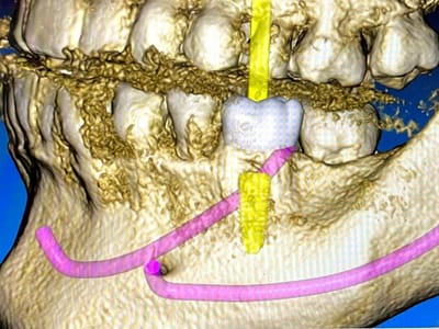 Luxadent Dentist in Houston