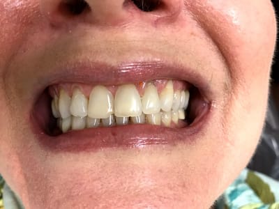 Luxadent Dentist in Houston